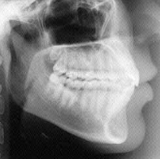 Radiologia Odontológica em Blumenau